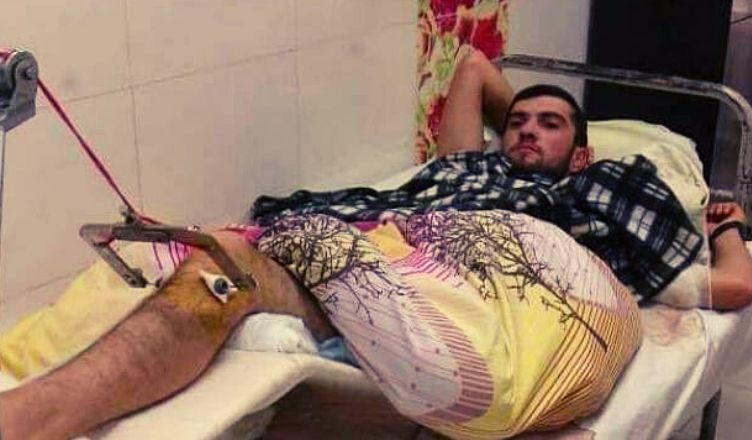 Արցախում ադրբեջանցի ռազմագերուն բուժօգնություն է ցուցաբերվում, նա վիրահատվել է